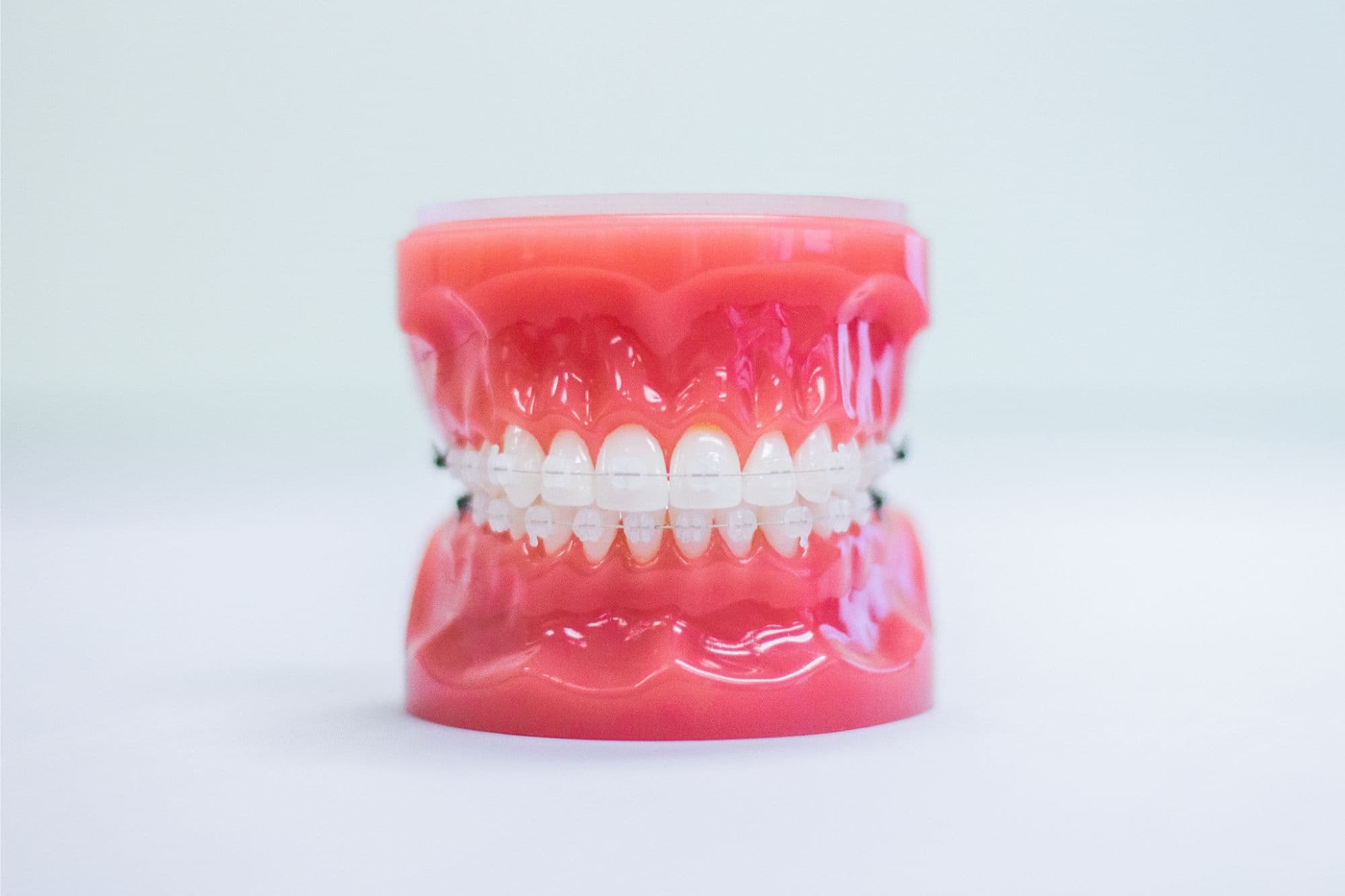 clear braces on a plastic model
