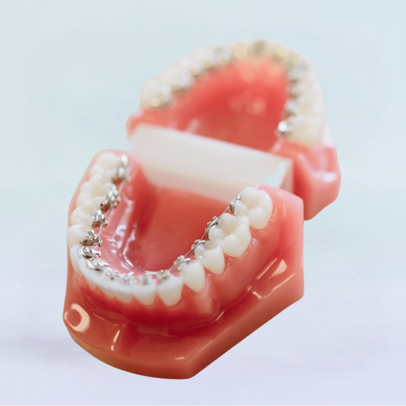 lingual-braces